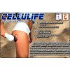 Vakuový přístroj pro redukci celulitidy CELLULIFE Vakuový přístroj pro redukci celulitidy CELLULIFE