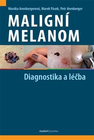 Maligní melanom - Diagnostika a léčba - Monika Arenbergerová