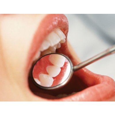 Odstranění nevzhledných pigmentů z povrchu zubů