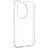 Fixed Story TPU gélový kryt pre Honor 400 Pro, číry FIXTCC-1553-TR