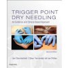 Trigger Point Dry Needling Trigger Point Dry Needling