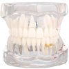 Model čeľuste, transparentný Model čeľuste, transparentný