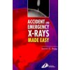 Accident and Emergency X-Rays Made Easy (James Begg)() Accident and Emergency X-Rays Made Easy (James Begg)()