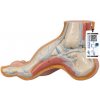 Model vyklenuté nohy (pes cavus) (Anatomické modely) Model vyklenuté nohy (pes cavus) (Anatomické modely)