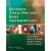 Revision Total Hip and Knee Arthroplasty (Daniel Berry)(Pevná) Revision Total Hip and Knee Arthroplasty (Daniel Berry)(Pevná)