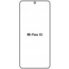 engaroGuard Hydrogel - ochranná fólia - Xiaomi Poco X3 priesvitná nepoužívam kryt = fólia na celý displej 1 kus s výrezom prednej kamery engaroGuard Hydrogel - ochranná fólia - Xiaomi Poco X3 priesvitná nepoužívam kryt = fólia na celý displej 1 kus s výrezom prednej kamery