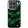 Picasee silikónový prehľadný obal pre Xiaomi 15 - Emerald Picasee silikónový prehľadný obal pre Xiaomi 15 - Emerald