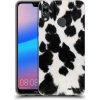 Picasee silikónový čierny obal pre Huawei P20 Lite - Black Moo Picasee silikónový čierny obal pre Huawei P20 Lite - Black Moo