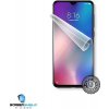 Ochranná fólia Screensheld XIAOMI Mi 9 SE - displej