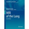 MRI of the Lung (Hans-Ulrich Kauczor,Mark Oliver Wielpütz)(Brožovaná) MRI of the Lung (Hans-Ulrich Kauczor,Mark Oliver Wielpütz)(Brožovaná)