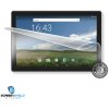 Screenshield™ UMAX VisionBook 10Ai fólia na displej Screenshield™ UMAX VisionBook 10Ai fólia na displej