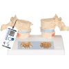 Didaktický model osteoporózy (Anatomické modely) Didaktický model osteoporózy (Anatomické modely)