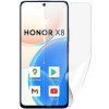 Ochranná fólia ScreenShield HONOR X8 - displej
