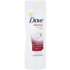 Dove Intensive Nourishing Lotion - Telové mlieko pre veľmi suchú pokožku 400 ml Dove Intensive Nourishing Lotion - Telové mlieko pre veľmi suchú pokožku 400 ml