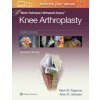 Master Techniques in Orthopedic Surgery: Knee Arthroplasty Master Techniques in Orthopedic Surgery: Knee Arthroplasty
