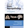 Atlas of Gross Neuropathology Book and Online Bundle Atlas of Gross Neuropathology Book and Online Bundle