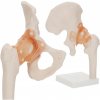 4FIZJO Anatomický model bedrového kĺbu s väzmi v mierke 1:1 4FIZJO Anatomický model bedrového kĺbu s väzmi v mierke 1:1