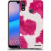 Picasee silikónový čierny obal pre Huawei P20 Lite - Pink Moo Picasee silikónový čierny obal pre Huawei P20 Lite - Pink Moo