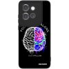 Picasee ULTIMATE CASE pro Motorola Edge 50 Neo - Brain - White Picasee ULTIMATE CASE pro Motorola Edge 50 Neo - Brain - White