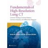 Fundamentals of High-Resolution Lung CT (Elicker,Brett M,MD,W. Richard Webb)(Brožovaná) Fundamentals of High-Resolution Lung CT (Elicker,Brett M,MD,W. Richard Webb)(Brožovaná)