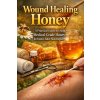 Wound Healing Honey (April Fox)(Brožovaná) Wound Healing Honey (April Fox)(Brožovaná)