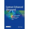 Contrast-Enhanced Ultrasound (Alexander N. Sencha,Yury N. Patrunov)(Brožovaná) Contrast-Enhanced Ultrasound (Alexander N. Sencha,Yury N. Patrunov)(Brožovaná)