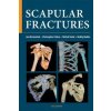 Scapular fractures - Jan Bartoníček, Christopher Colton, Michal Tuček, Ondřej Naňka Scapular fractures - Jan Bartoníček, Christopher Colton, Michal Tuček, Ondřej Naňka