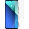 Screenshield XIAOMI Redmi Note 13 fólia na displej XIA-REDNO13-D Screenshield XIAOMI Redmi Note 13 fólia na displej XIA-REDNO13-D