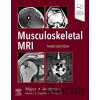 Musculoskeletal MRI - Nancy M. Major, Mark W. Anderson Musculoskeletal MRI - Nancy M. Major, Mark W. Anderson