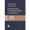 Diagnostika zlomenin pánve a acetabula - Jana Chmelová Diagnostika zlomenin pánve a acetabula - Jana Chmelová