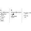 Matopat Dialyzačný set v blistri a vrecku pre 2 procedúry 2 Matopat Dialyzačný set v blistri a vrecku pre 2 procedúry 2