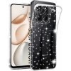 Techsuit - SparkleSkin Series - Honor 400 Smart 5G / 400 Smart 4G / X7d 4G - Clear