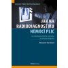 Jak na radiodiagnostiku nemocí plic - Jaroslav Polák, Martina Vašáková Jak na radiodiagnostiku nemocí plic - Jaroslav Polák, Martina Vašáková