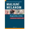 Maligní melanom Diagnostika a léčba - Petr Arenberger Maligní melanom Diagnostika a léčba - Petr Arenberger