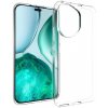 VSETKONAMOBIL 114701 TPU Ochranný kryt pre Honor 400 5G priehľadný VSETKONAMOBIL 114701 TPU Ochranný kryt pre Honor 400 5G priehľadný