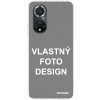 Picasee silikónový prehľadný obal pre Huawei Nova 9 SE - Vlastný design/motiv Picasee silikónový prehľadný obal pre Huawei Nova 9 SE - Vlastný design/motiv