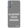 Picasee silikónové Motorola Moto G62 - Vlastný design/motiv čiré