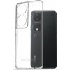 AlzaGuard Crystal Clear TPU Case pre Honor X7b (AGD-PCT401Z) AlzaGuard Crystal Clear TPU Case pre Honor X7b (AGD-PCT401Z)