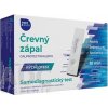 MAXIMEDICAL Rýchlotest Črevný zápal samodiagnostický test zo stolice, 1x1 set MAXIMEDICAL Rýchlotest Črevný zápal samodiagnostický test zo stolice, 1x1 set