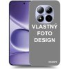 Picasee silikónový čierny obal pre Xiaomi Redmi Note 15 Pro - Vlastný design/motiv