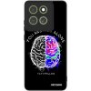 Picasee ULTIMATE CASE pro Motorola Moto G86 Power 5G - Brain - White Picasee ULTIMATE CASE pro Motorola Moto G86 Power 5G - Brain - White