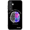 Picasee ULTIMATE CASE pro Samsung Galaxy A55 5G A556B - Brain - White Picasee ULTIMATE CASE pro Samsung Galaxy A55 5G A556B - Brain - White