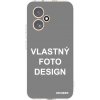 Picasee silikónový prehľadný obal pre Honor 400 5G - Vlastný design/motiv