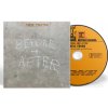 Young Neil: Before And After - CD Young Neil: Before And After - CD