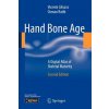 Hand Bone Age Hand Bone Age