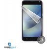 Screenshield ASUS Zenfone 4 Max ZC554KL fólia na displej Screenshield ASUS Zenfone 4 Max ZC554KL fólia na displej