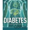 Diabetes: Prevencia, diagnostika, liečba - Rosemary Walker Diabetes: Prevencia, diagnostika, liečba - Rosemary Walker