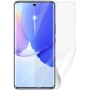 Screenshield HUAWEI Nova 9 na displej HUA-NOVA9-D Screenshield HUAWEI Nova 9 na displej HUA-NOVA9-D