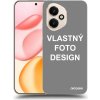 Picasee Ultimate Case pro Honor 400 5G - Vlastný design/motiv Picasee Ultimate Case pro Honor 400 5G - Vlastný design/motiv