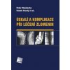 Úskalí a komplikace při léčení zlomenin (Peter Wendsche, Radek Veselý) Úskalí a komplikace při léčení zlomenin (Peter Wendsche, Radek Veselý)